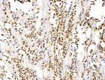 LMX1A Antibody in Immunohistochemistry (Paraffin) (IHC (P))