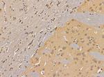 LOR Antibody in Immunohistochemistry (Paraffin) (IHC (P))