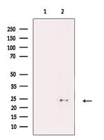 LOR Antibody in Western Blot (WB)