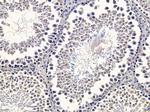 KARS Antibody in Immunohistochemistry (Paraffin) (IHC (P))