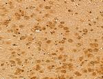 LZTFL1 Antibody in Immunohistochemistry (Paraffin) (IHC (P))