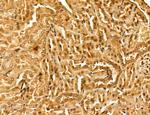 LZTFL1 Antibody in Immunohistochemistry (Paraffin) (IHC (P))