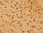 LZTFL1 Antibody in Immunohistochemistry (Paraffin) (IHC (P))