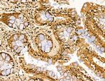 LZTFL1 Antibody in Immunohistochemistry (Paraffin) (IHC (P))