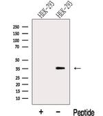 LZTFL1 Antibody in Western Blot (WB)