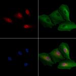 Histone Macro-H2A.1 Antibody in Immunocytochemistry (ICC/IF)