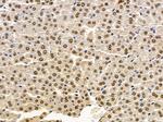 MAGEA4 Antibody in Immunohistochemistry (Paraffin) (IHC (P))