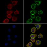 MAGEB1 Antibody in Immunocytochemistry (ICC/IF)