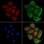 MARS Antibody in Immunocytochemistry (ICC/IF)