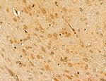 MARS Antibody in Immunohistochemistry (Paraffin) (IHC (P))