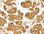 MARS Antibody in Immunohistochemistry (Paraffin) (IHC (P))