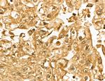 MARS Antibody in Immunohistochemistry (Paraffin) (IHC (P))