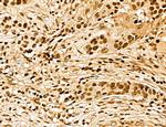 MARS Antibody in Immunohistochemistry (Paraffin) (IHC (P))