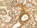 MARS Antibody in Immunohistochemistry (Paraffin) (IHC (P))