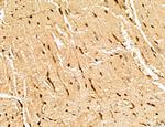 MARS Antibody in Immunohistochemistry (Paraffin) (IHC (P))