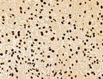 MARS Antibody in Immunohistochemistry (Paraffin) (IHC (P))