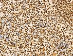 MARS Antibody in Immunohistochemistry (Paraffin) (IHC (P))