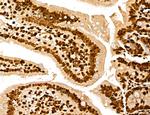 MARS Antibody in Immunohistochemistry (Paraffin) (IHC (P))