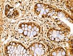 MARS Antibody in Immunohistochemistry (Paraffin) (IHC (P))