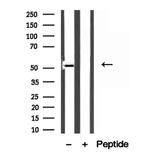 MAT1A Antibody in Western Blot (WB)