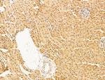 MBD4 Antibody in Immunohistochemistry (Paraffin) (IHC (P))