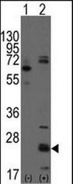 CD9 Antibody in Western Blot (WB)