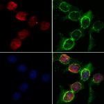 MEF2C Antibody in Immunocytochemistry (ICC/IF)