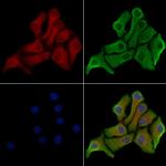 MLKL Antibody in Immunocytochemistry (ICC/IF)