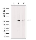 MLKL Antibody in Western Blot (WB)