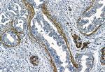 MMP2 Antibody in Immunohistochemistry (Paraffin) (IHC (P))