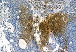 MMP2 Antibody in Immunohistochemistry (Paraffin) (IHC (P))