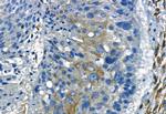 MMP2 Antibody in Immunohistochemistry (Paraffin) (IHC (P))