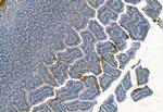 MMP2 Antibody in Immunohistochemistry (Paraffin) (IHC (P))