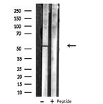 MNK1 Antibody in Western Blot (WB)