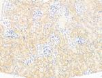 MOV10 Antibody in Immunohistochemistry (Paraffin) (IHC (P))