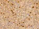 MSH4 Antibody in Immunohistochemistry (Paraffin) (IHC (P))