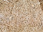 MTA1 Antibody in Immunohistochemistry (Paraffin) (IHC (P))