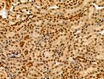 MTA1 Antibody in Immunohistochemistry (Paraffin) (IHC (P))