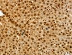 MTA1 Antibody in Immunohistochemistry (Paraffin) (IHC (P))