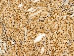 MTA1 Antibody in Immunohistochemistry (Paraffin) (IHC (P))