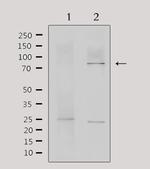 MTA1 Antibody in Western Blot (WB)