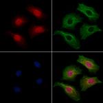 MTUS1 Antibody in Immunocytochemistry (ICC/IF)