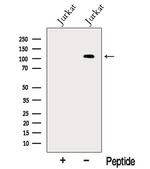 MTUS1 Antibody in Western Blot (WB)