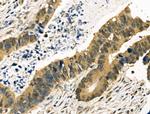 MYF5 Antibody in Immunohistochemistry (Paraffin) (IHC (P))