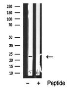 NACA Antibody in Western Blot (WB)