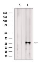 NAT14 Antibody in Western Blot (WB)