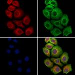 SCN5A Antibody in Immunocytochemistry (ICC/IF)