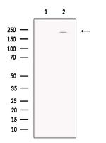 SCN5A Antibody in Western Blot (WB)