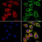 SCN10A Antibody in Immunocytochemistry (ICC/IF)