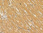 SCN10A Antibody in Immunohistochemistry (Paraffin) (IHC (P))